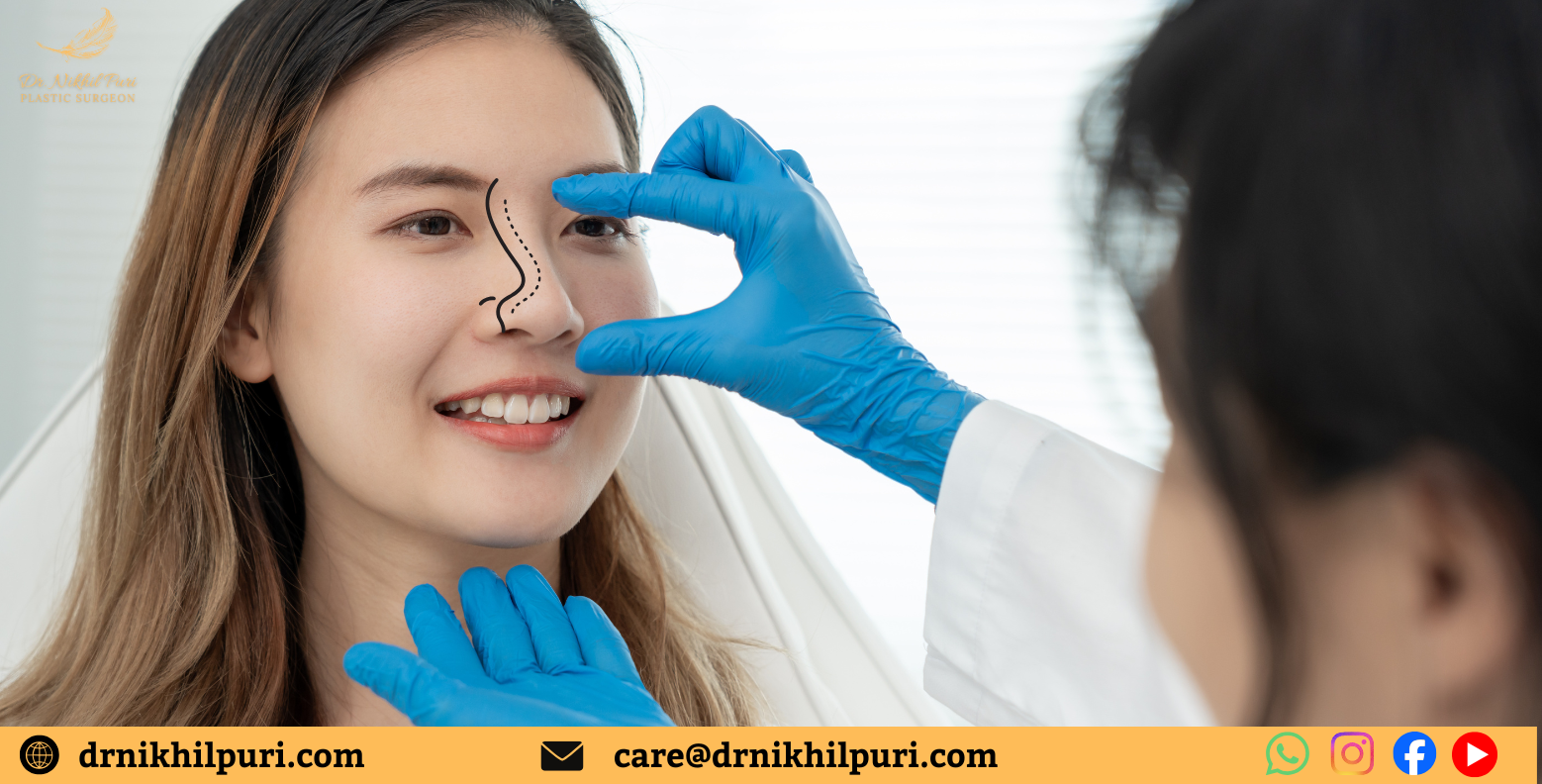 Rhinoplasty Recovery Timeline: Post-op Care & Healing Process Guide