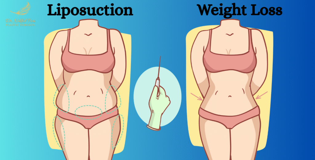 Liposuction vs Weight Loss