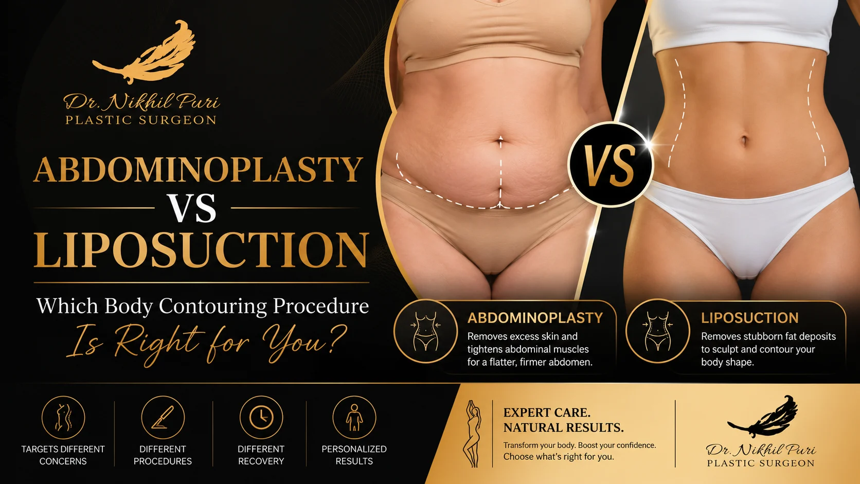 Abdominoplasty vs Liposuction: Which Body Contouring Procedure Is Right for You?